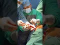 #doctor # dhs #orthopaedic