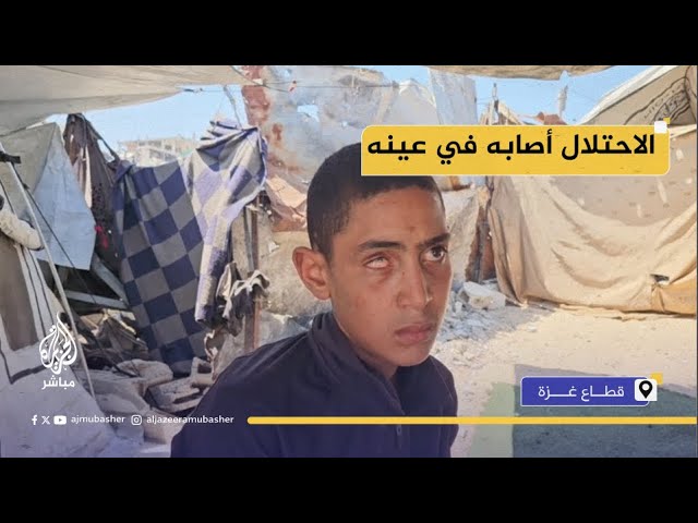 فتى فلسطيني يناشد بمعالجة عينه