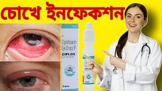 Ciplox Eye Drops Ciplox Eye Drops Uses In Bengali Eye Drops চখর ডরপ