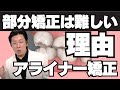 部分矯正が難しい理由について説明します〜アライナー矯正治療は奥歯が噛めない？編〜