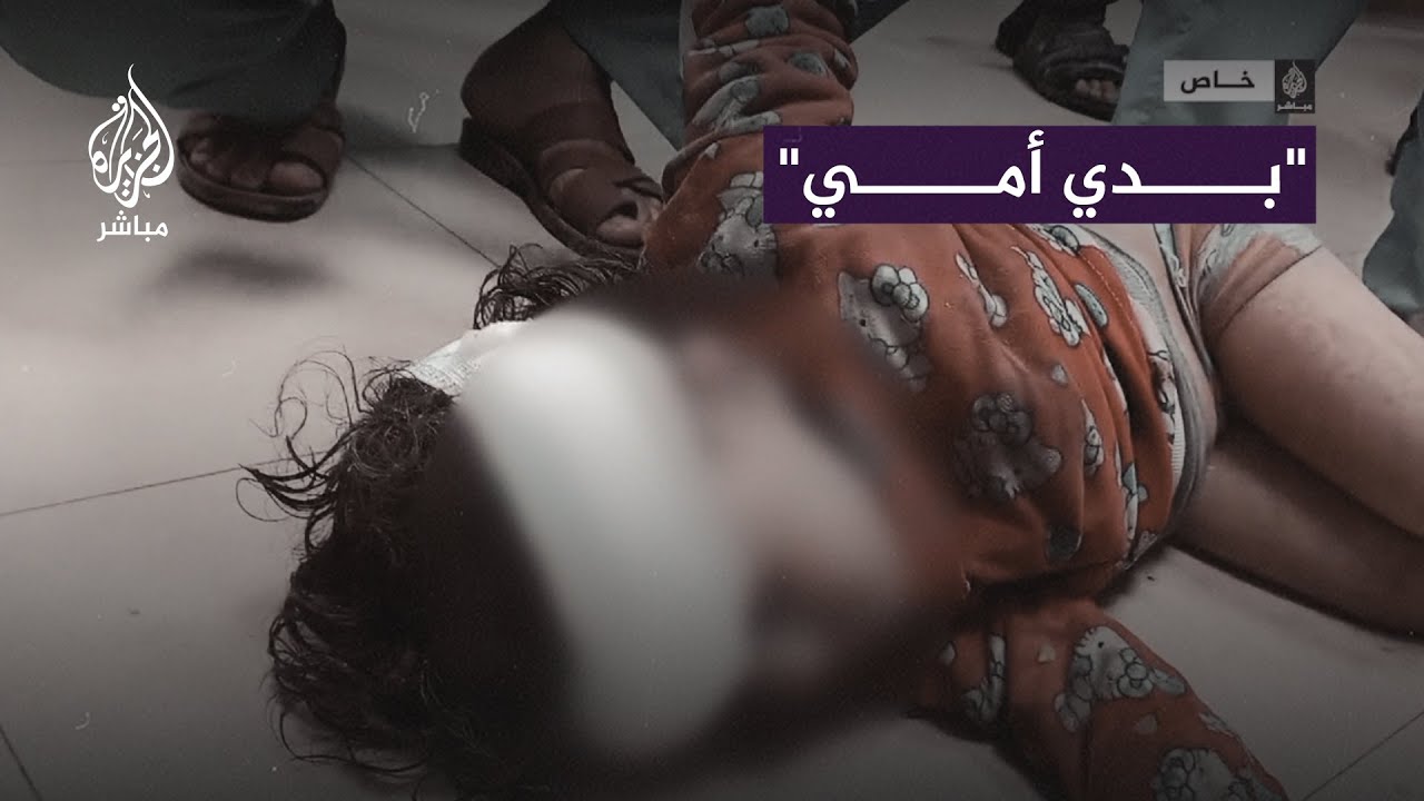 مشاهد مأساوية لأطفال مصابين بعد غارة إسرائيلية استهدفت منزلا بمدينة النصيرات