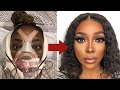 My Plastic Surgery Experience In Korea Part 2 | Recovery and My New Face..