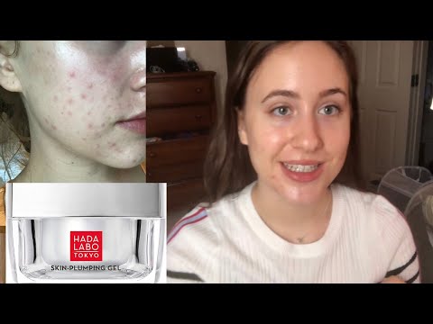 Hada Labo skin plumping gel cream review on dry acne prone skin