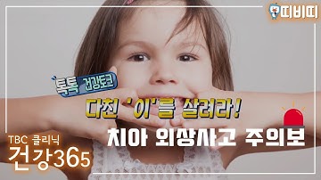 치아 외상사고 주의보! 다친