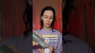 арт. #WW147053 - не повторяйте моих ошибок!🥲 #черныеточки #комедоны РП