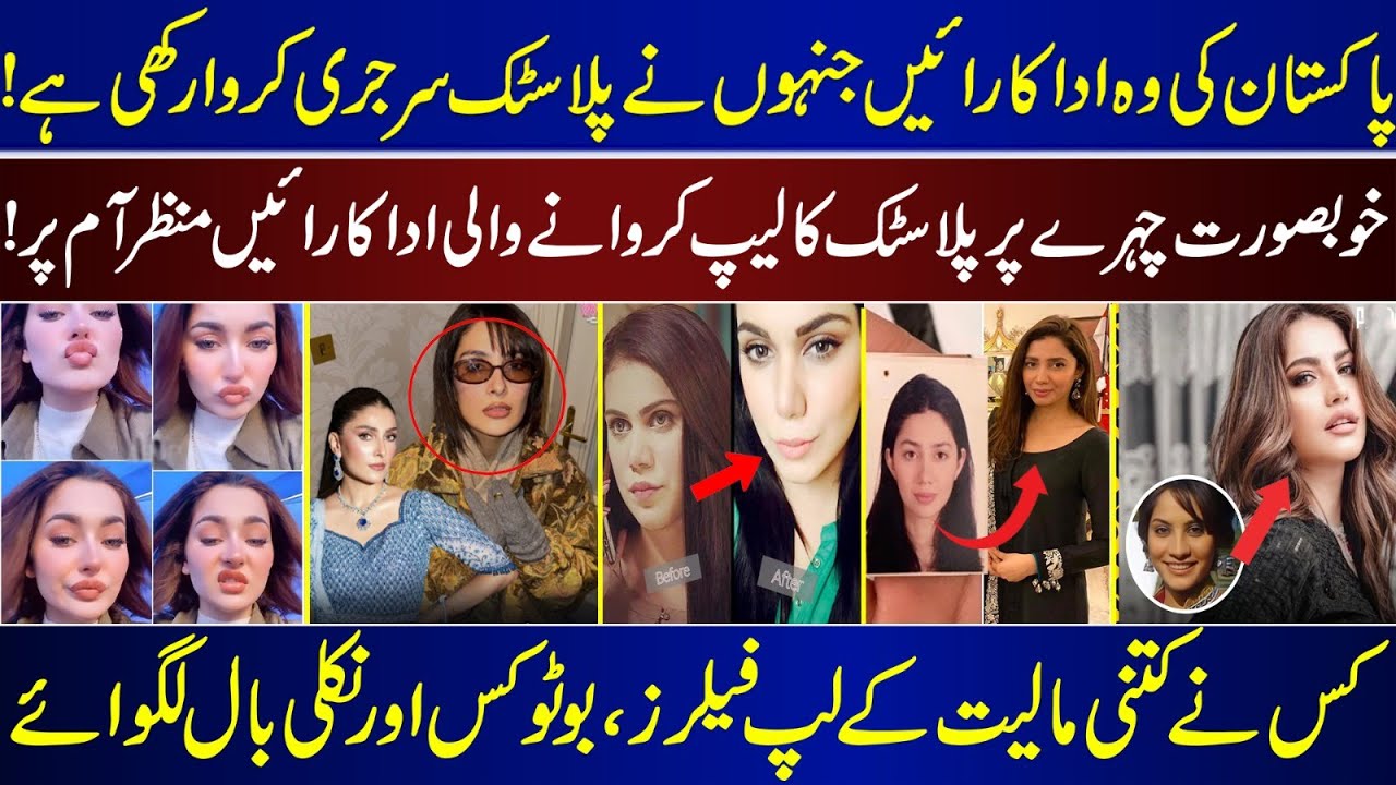 Famous Pakistani Actresses Who Have Undergone Plastic Surgery | Who Got Lip Fillers And Botox |
