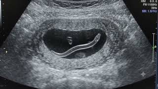 Fake Stomach Ultrasound Scan 😱  What’s Inside  Kids Prank