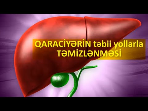 Video: Qaraciyərin təbii yollarla müalicəsinin 4 yolu