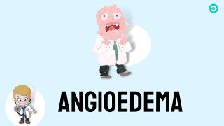 Angioedema: signs & symptoms, causes, and treatment