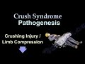 Crush Syndrome, Earthquake injuries. Crush syndrome symptoms, diagnosis and treatment .