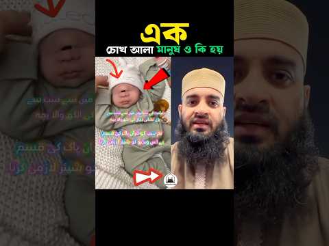 এক চোখ ওয়ালা মানুষ কি হয় 😭 Mizanur Rahman azhari #namaz #islam #trending #shorts #mizanur