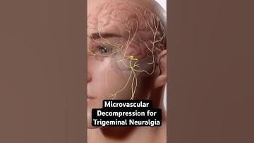 Most excruciating pain known to humanity (3D Animation)