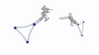 VELYS Robotic-Assisted Solution Knee Replacement Procedure at Cheyenne Regional - 2 min 45 sec video