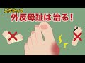 こうやって外反母趾は治る！