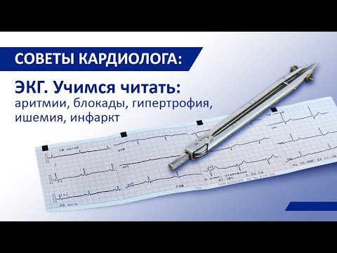 Видео: Как положить отведения ЭКГ на грудь: 15 шагов (с иллюстрациями)