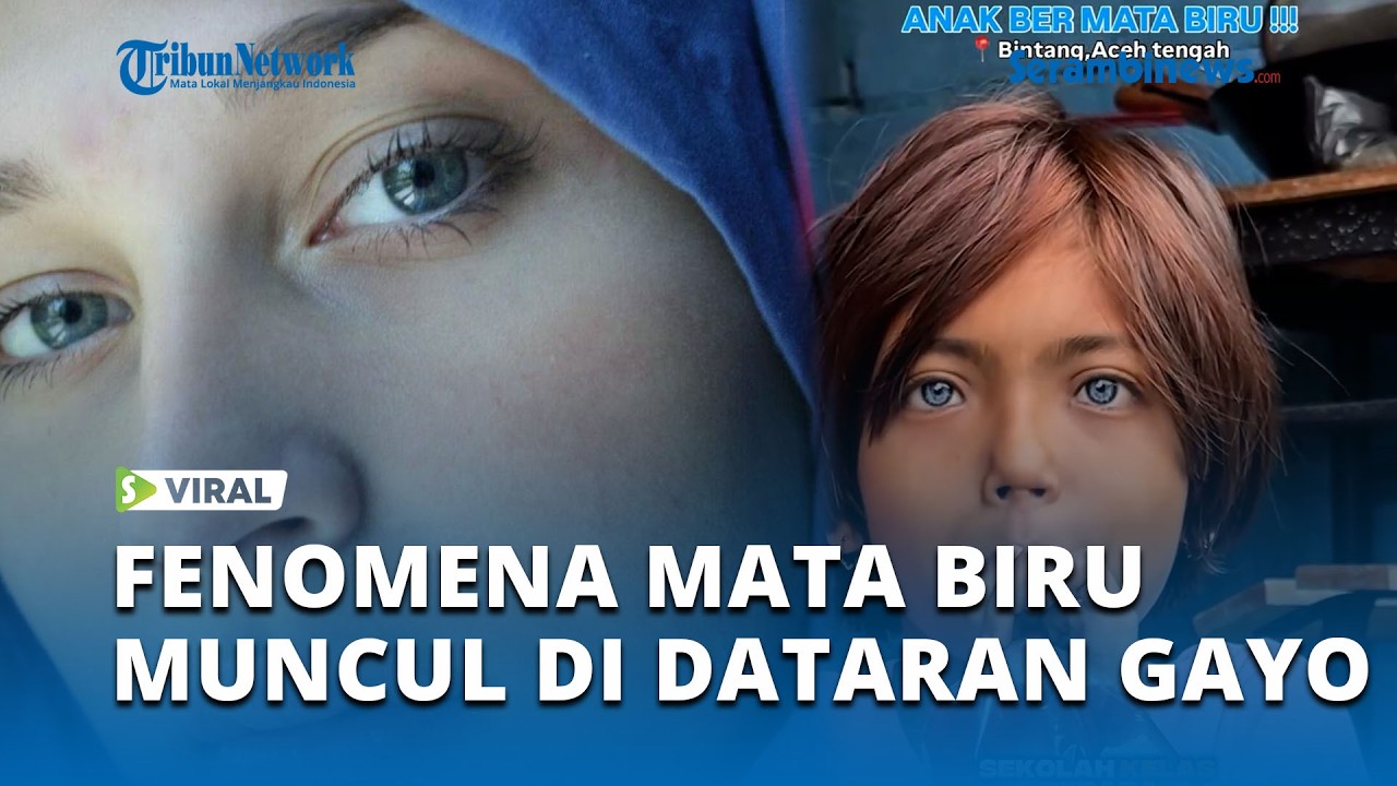 Heboh! Fenomena Warga Bermata Biru di Aceh Tengah Diduga Jejak Genetik Masa Lalu