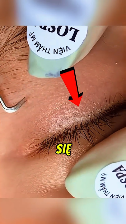 The doctor immediately responded to the swelling above the eye😨