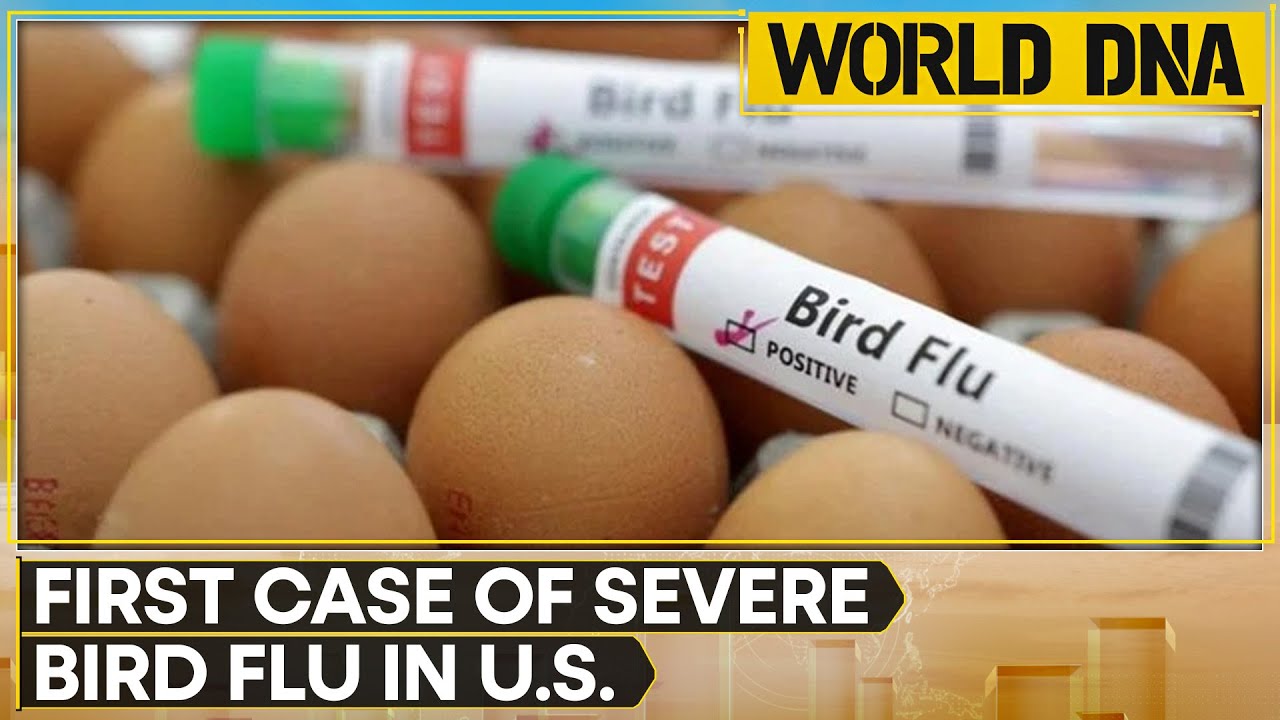 First Severe Human Case Of Bird Flu In US Confirmed | WION World DNA ...