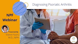 Diagnosing Psoriatic Arthritis Dx Code For Psoriatic Arthritis