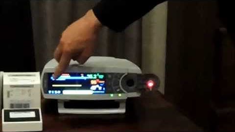 SDMS Membrane Change