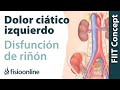 Ciatica o ciatalgia izquierda y su relación con la disfunción de riñón