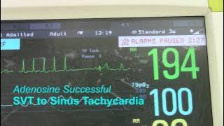 Download lagu SVT or Supraventricular Tachycardia