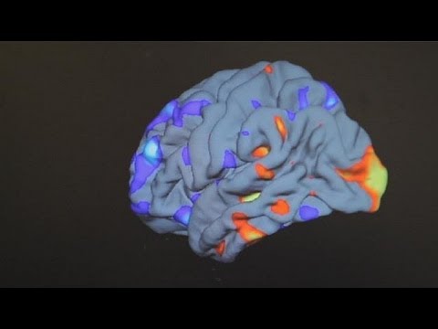 Vídeo: El Gen Del Receptor De Oxitocina Predice La Actividad Cerebral Durante Una Tarea De Reconocimiento De Emociones En El Autismo