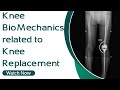 Knee biomechanics related to knee replacement