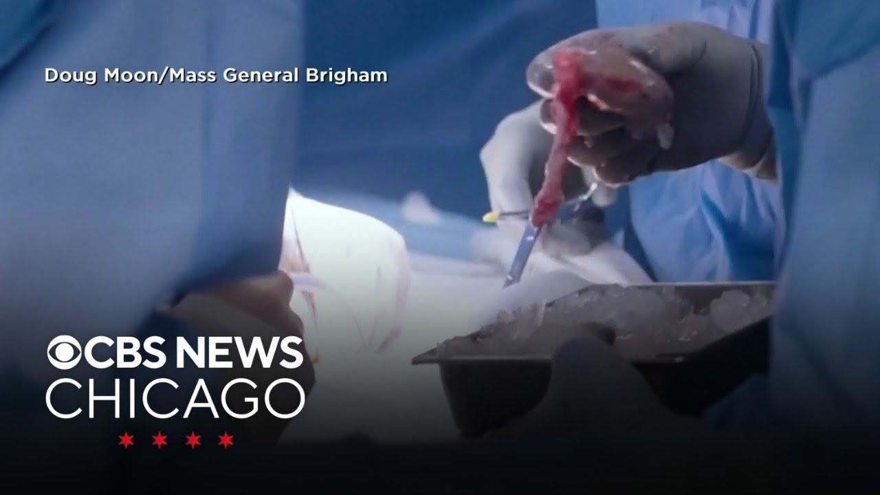 FDA greenlights human trials involving pig kidney transplants