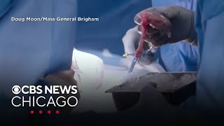 FDA greenlights human trials involving pig kidney transplants