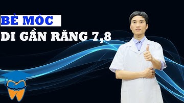 Bẻ Móc Di Gần Răng 7/ Răng 8 Thay Thế Răng 6 Bị Mất | Kiến Thức Chỉnh Nha