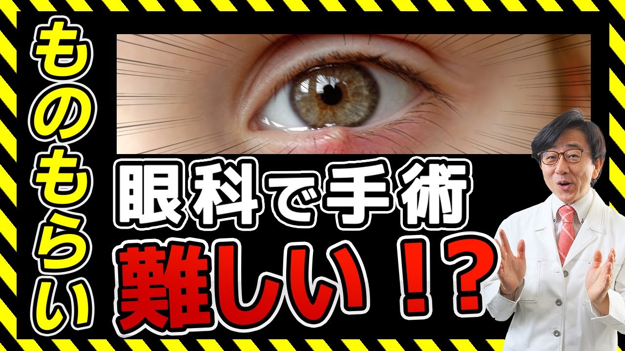 An Ophthalmologist Explains The Difficulty Of Stye Surgery Youtube
