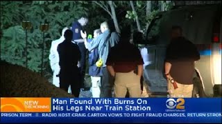 Man Found With Burns On His Legs At Glen Cove Train Station