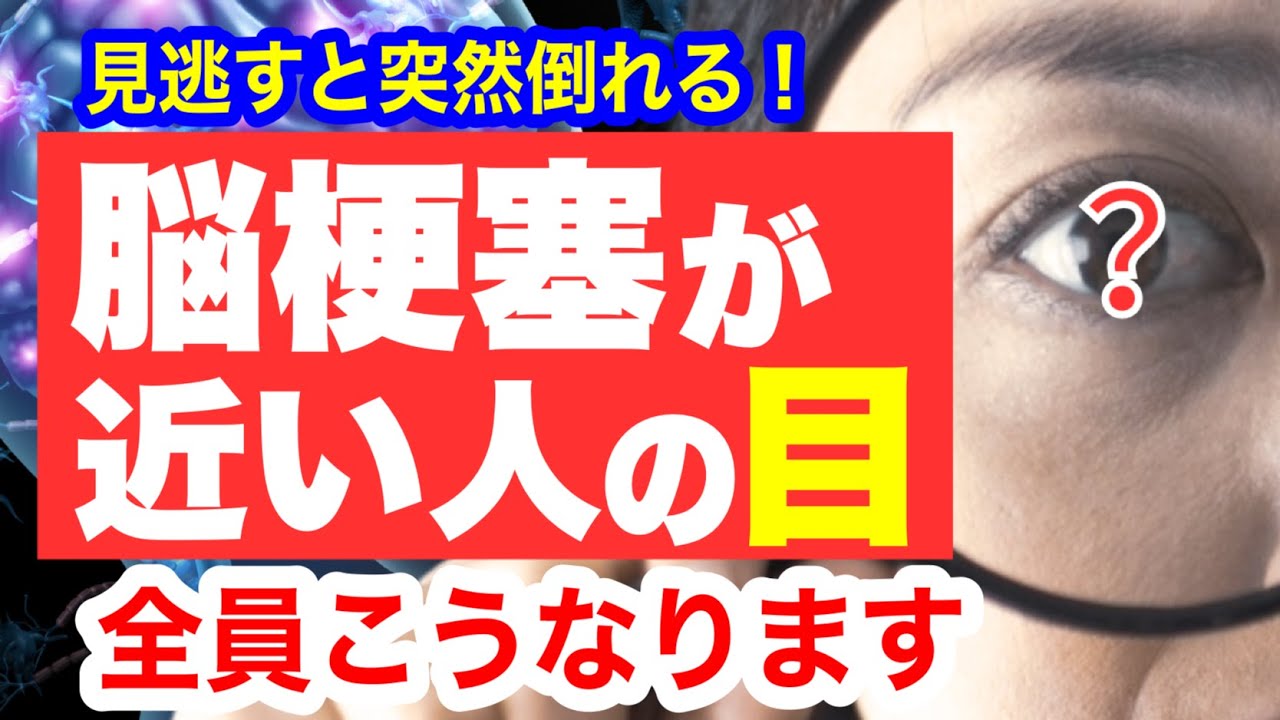 脳梗塞が近い人だけに起こる「目の異変」見逃すと突然倒れます!