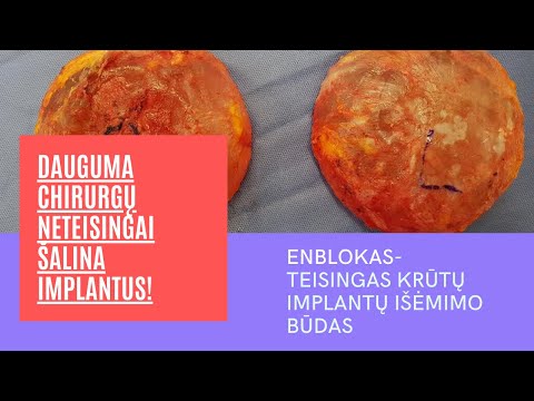 Video: Mielių Infekcija Paukščiams