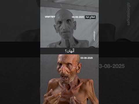 منظمة تركية تقدم مساعدات للمسن سليم