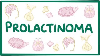 Prolactinoma  causes, symptoms, diagnosis, treatment, pathology