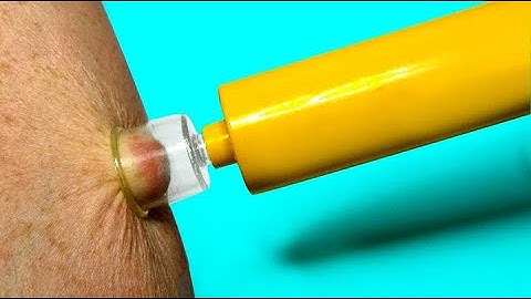 15 LIFE SAVING Inventions You Need To See!
