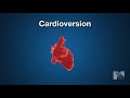 Cardioversion Procedure: Returning a heartbeat to normal rythm