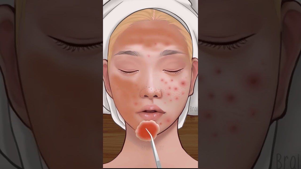 ASMR fast triggers 🌿 Relaxing Acne Prone skinca rroutine  