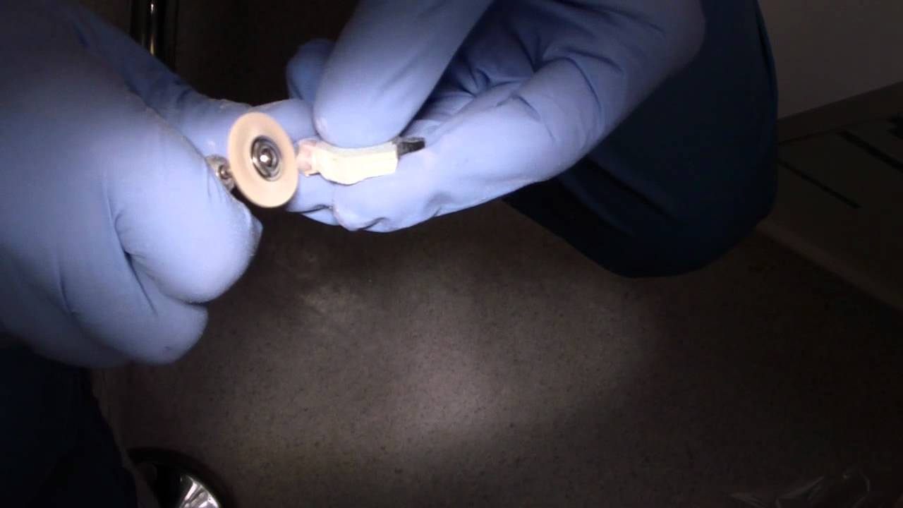 Polishing the Crown