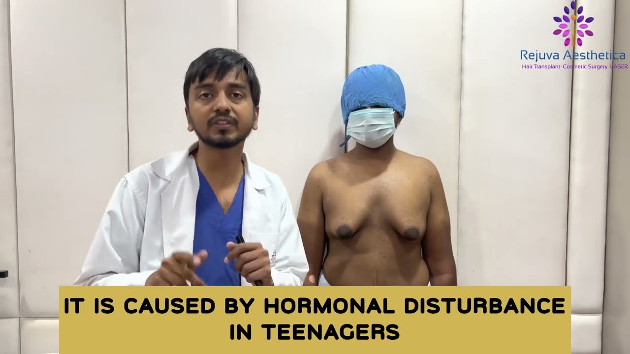 Can Teenage gynecomastia be cured by exercising, proper diet and Medication ? 
