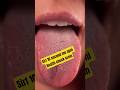 👅 Kya aapki jeebh bhi ye signs dikha rahi hai?#viral #facts #dailyfacts #shorts #shortvideo