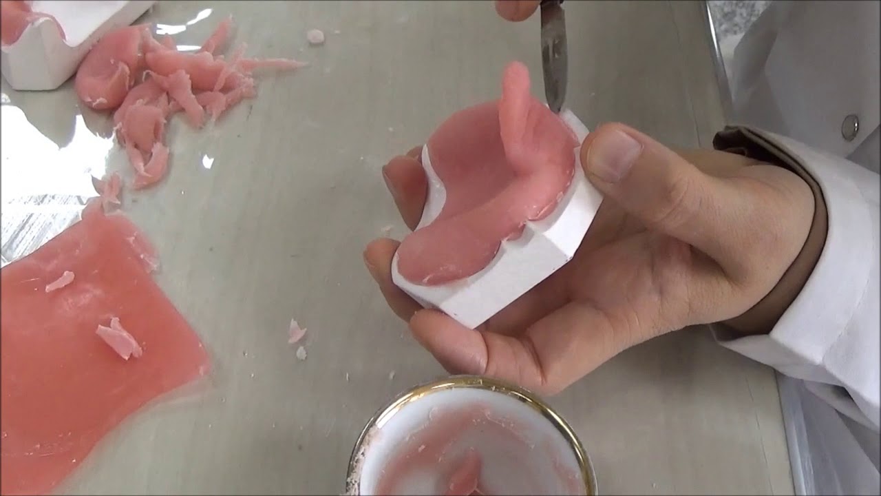 Special tray fabrication 6 YouTube