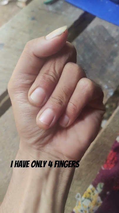 i Have only 4 finger#amazing #ai #world #god #myanmaryoutubechannel
