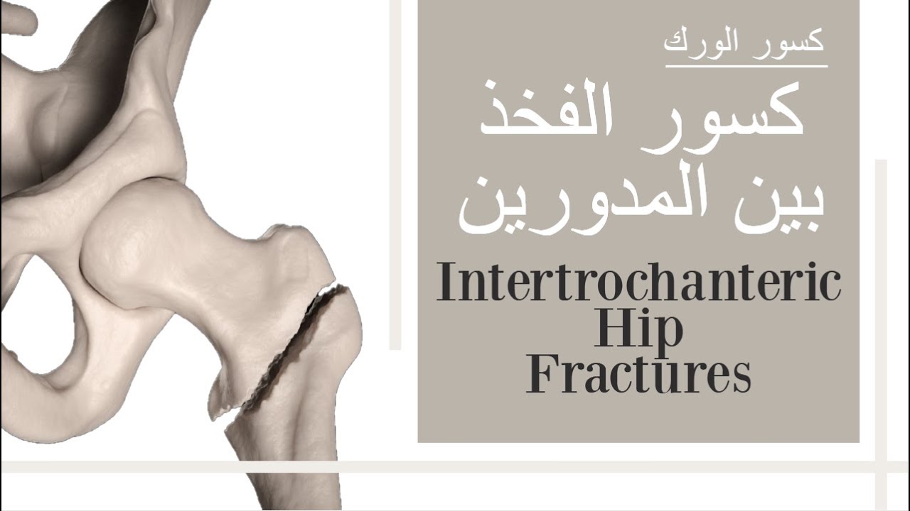 Межвертельные переломы бедра (субтитры)