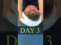 Utah Man Gets The Ring Dinger In Dallas To Avoid Back Surgery Ringdinger Chiropractic 