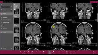 Mosaic - Athena DICOM Viewer