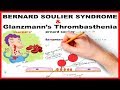 Bernard soulier syndrome  glanzmanns thrombasthenia  mnemonic series  21