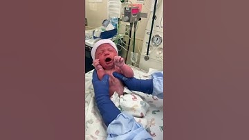 Thumbnail of Newborn Baby First Cry After C-Section #shorts #shortsvideo #shortsfeed #short #shortvideo #shots